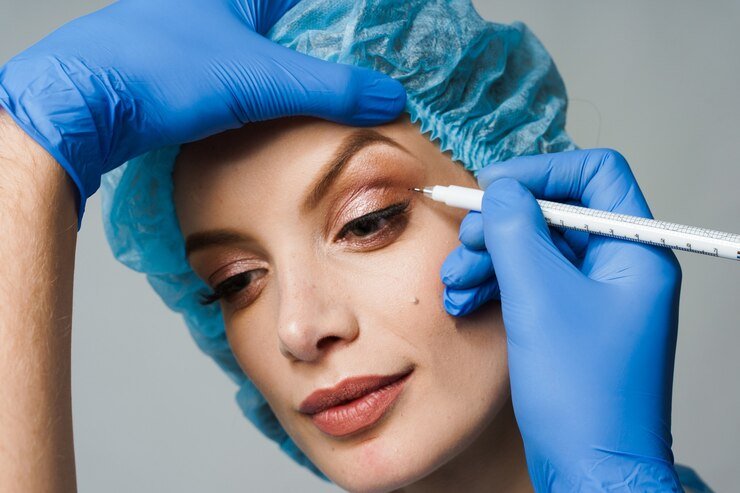 Plasma Pen Non Surgical Eye Lid Lift Treatment