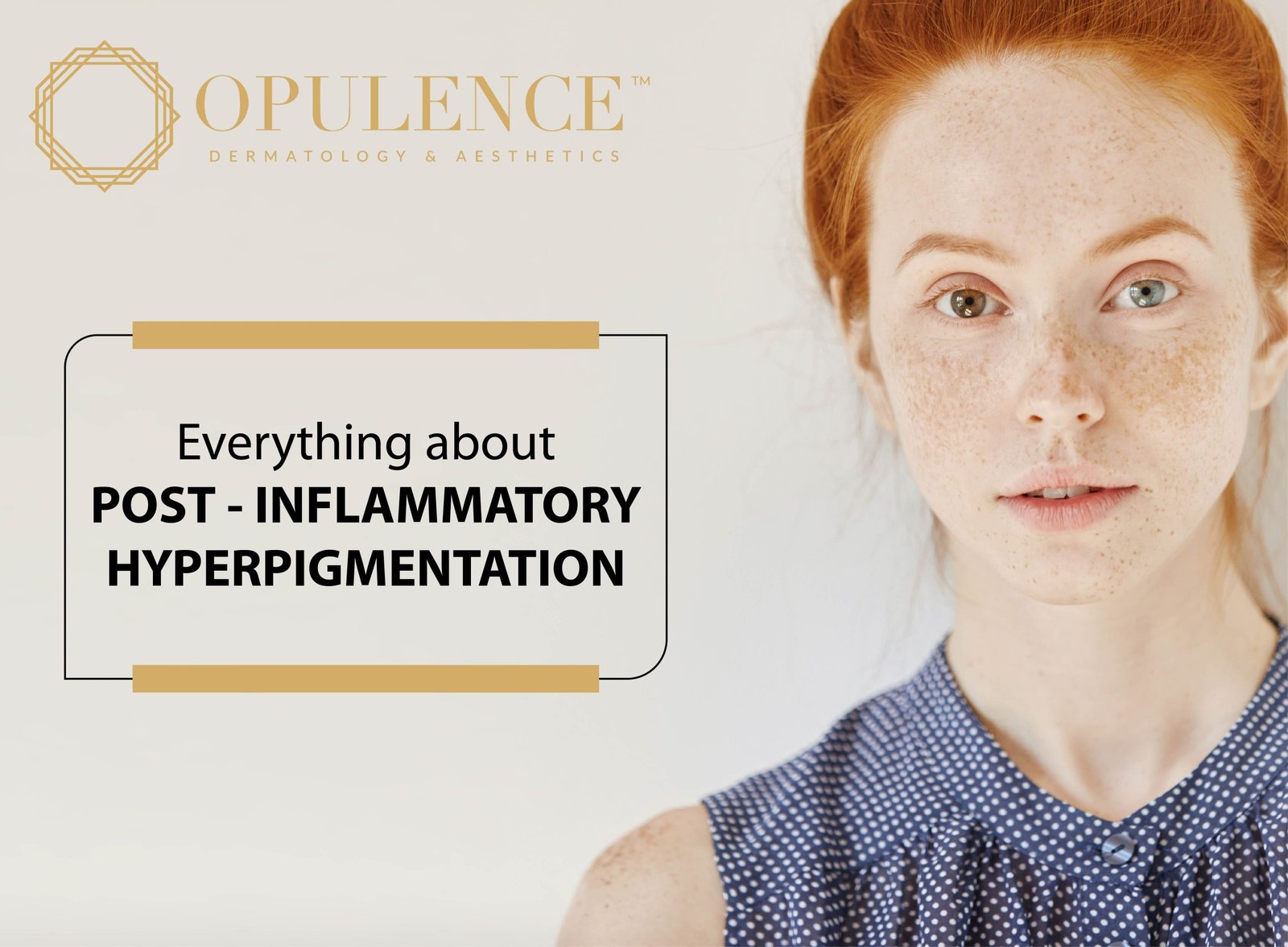 EVERYTHING ABOUT POST-INFLAMMATORY HYPERPIGMENTATION